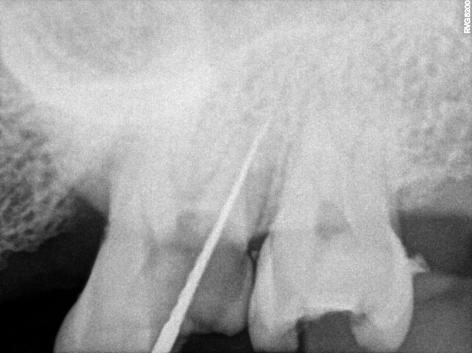 Dental X-ray